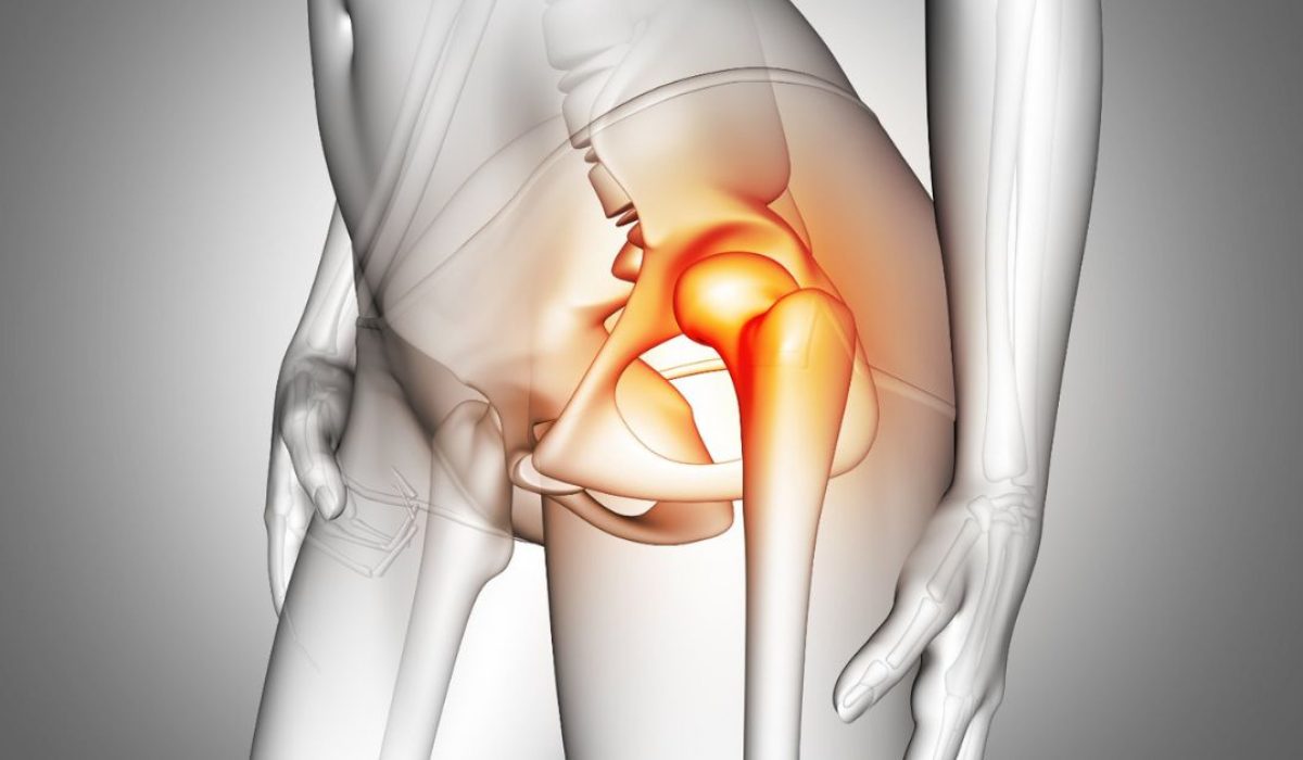 hip avn treatment in indore, best doctor for hip avn, nonoperative treatment for hip avn